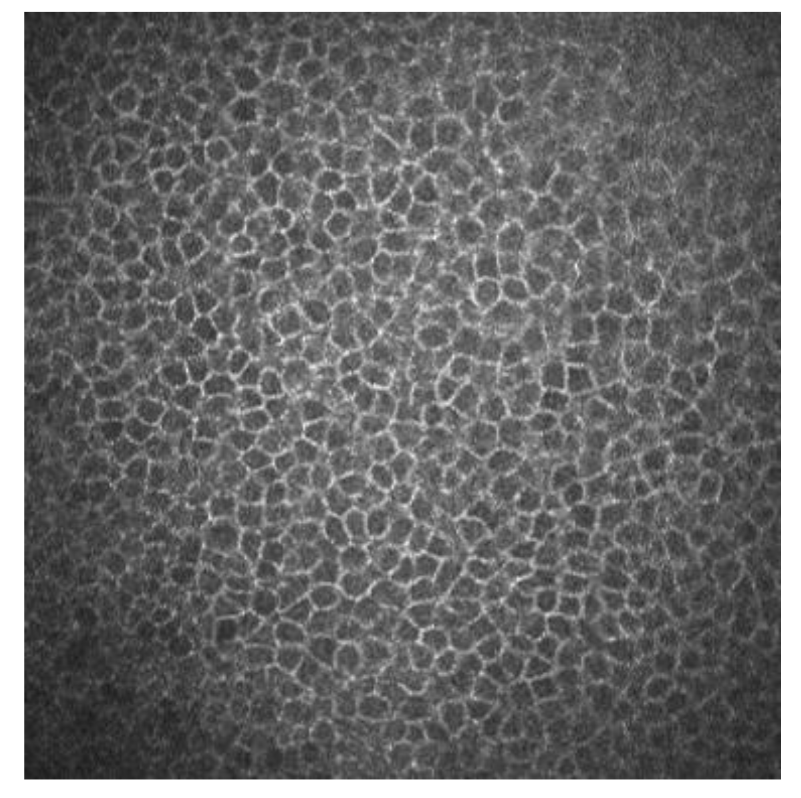 Epithelium.
