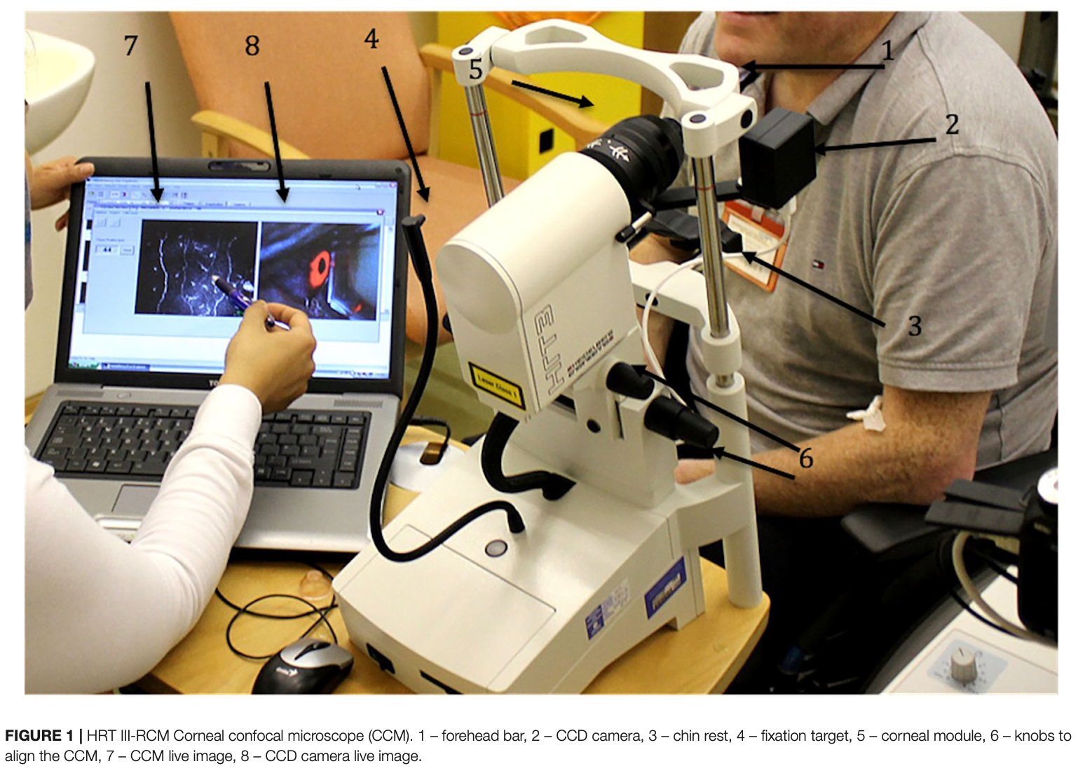 In Vivo Confocal Microscopy