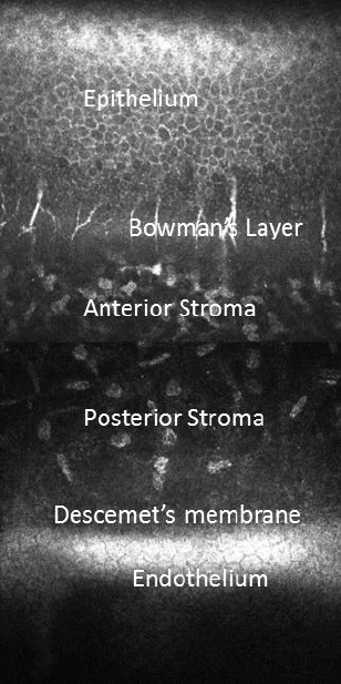Human cornea layers
