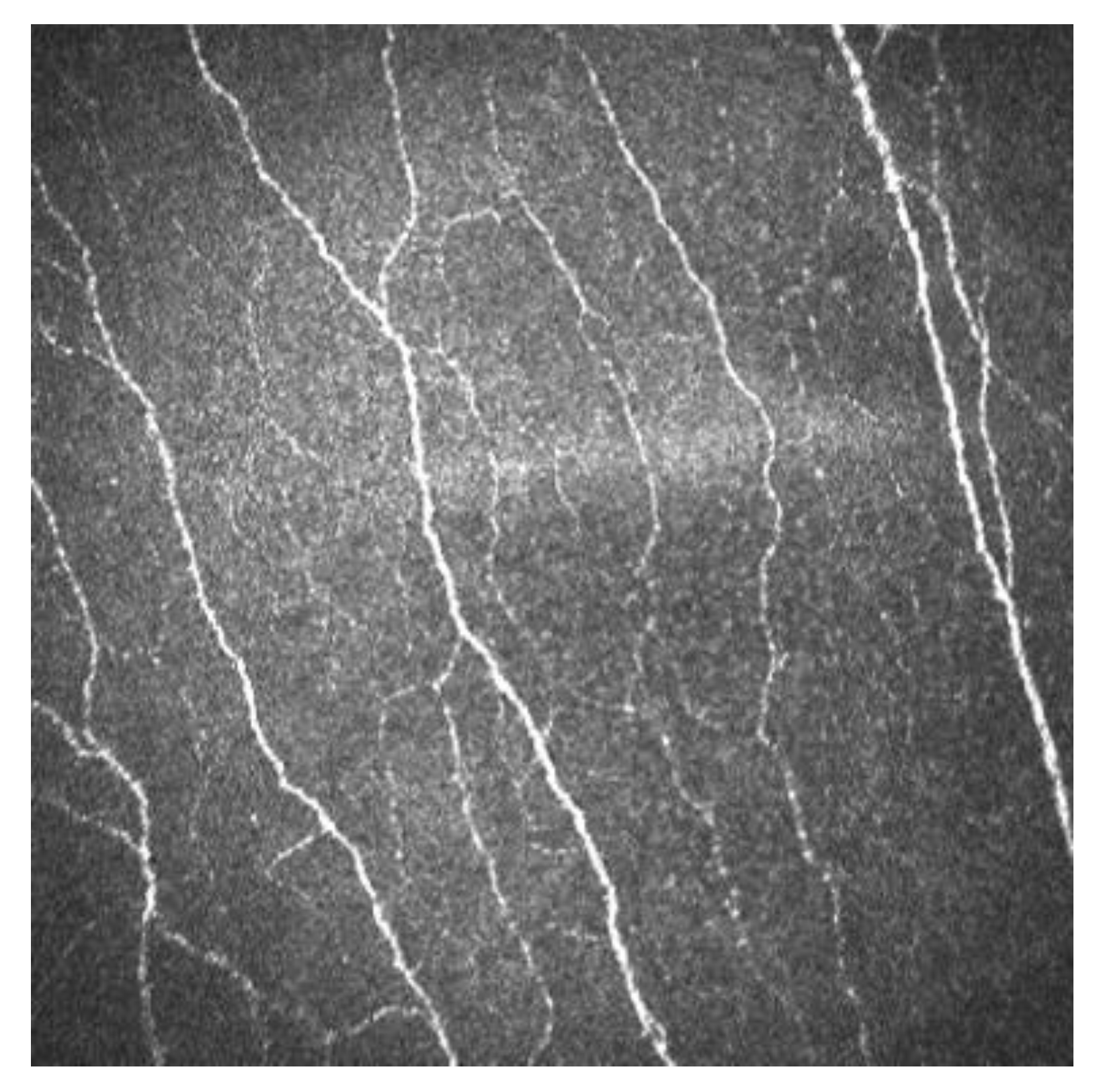 Subbasal Nerve Plexus.